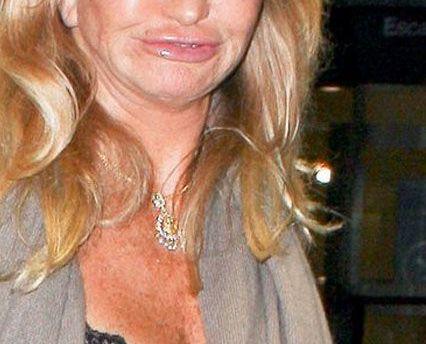 I s-a blocat faţa, din cauza operaţiilor estetice. Actriţa de la Hollywood care nu mai are expresie facială 182404