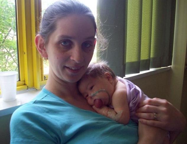 A păşit cu stângul în viaţă. Boala nu o lăsa să respire, să mănânce şi să zâmbească 183238