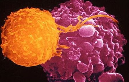 Un posibil tratament pentru cancer şi HIV a fost descoperit de oamenii de ştiinţă
