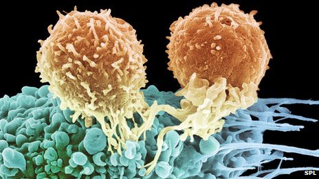 Vast numbers of cells that can attack cancer and HIV have been grown in the lab