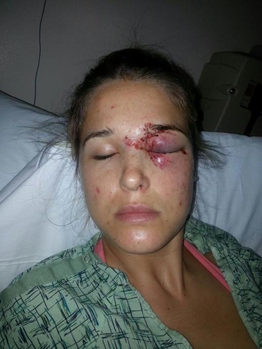 Aşa arată o femeie cunoscută de întreaga lume după ce a fost lovită de soţ. "Încă îl mai iubesc" 189126