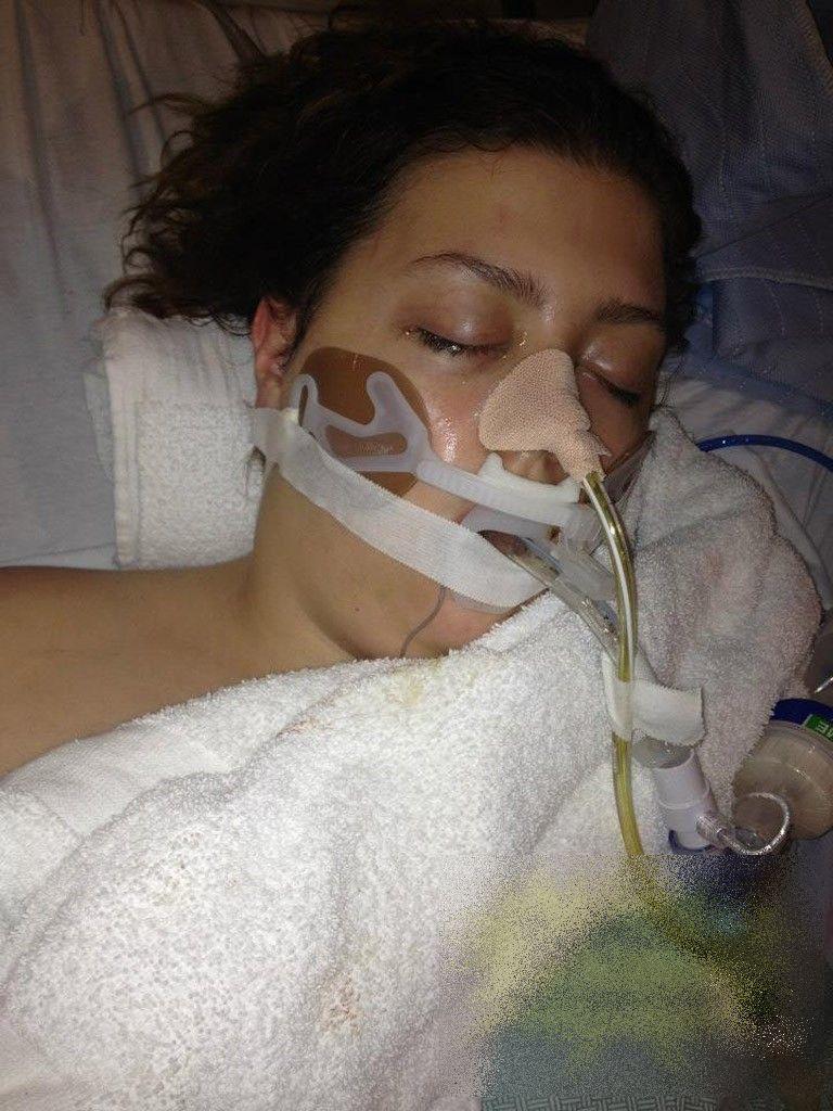 Cum a ajuns să arate această adolescentă de 17 ani după ce a consumat ETNOBOTANICE. Povestea e cutremurătoare 191684