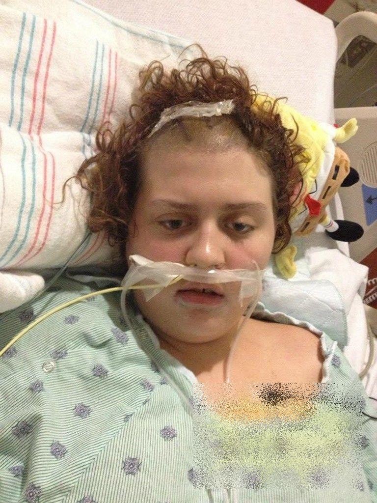 Cum a ajuns să arate această adolescentă de 17 ani după ce a consumat ETNOBOTANICE. Povestea e cutremurătoare 191685