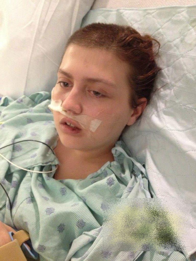 Cum a ajuns să arate această adolescentă de 17 ani după ce a consumat ETNOBOTANICE. Povestea e cutremurătoare 191687