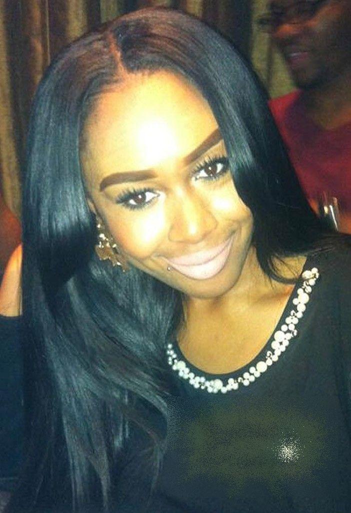 Mai avea 5 minute şi ajungea acasă. Ce i s-a întâmplat acestei tinere e îngrozitor. Acum nu se mai poate uita în oglindă 191669