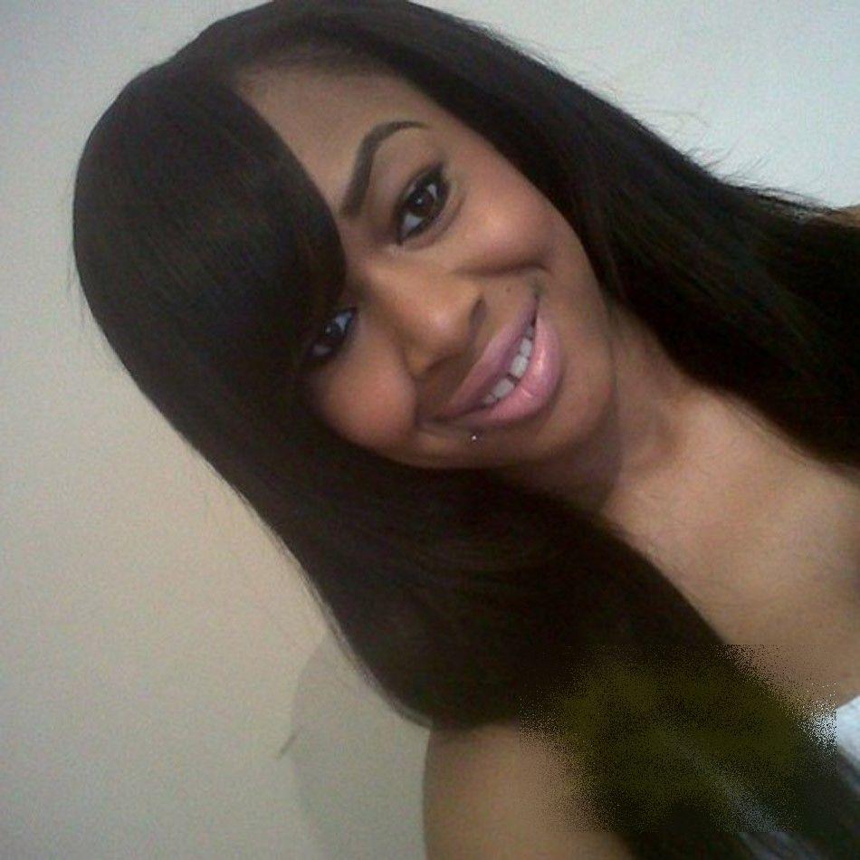 Mai avea 5 minute şi ajungea acasă. Ce i s-a întâmplat acestei tinere e îngrozitor. Acum nu se mai poate uita în oglindă 191670