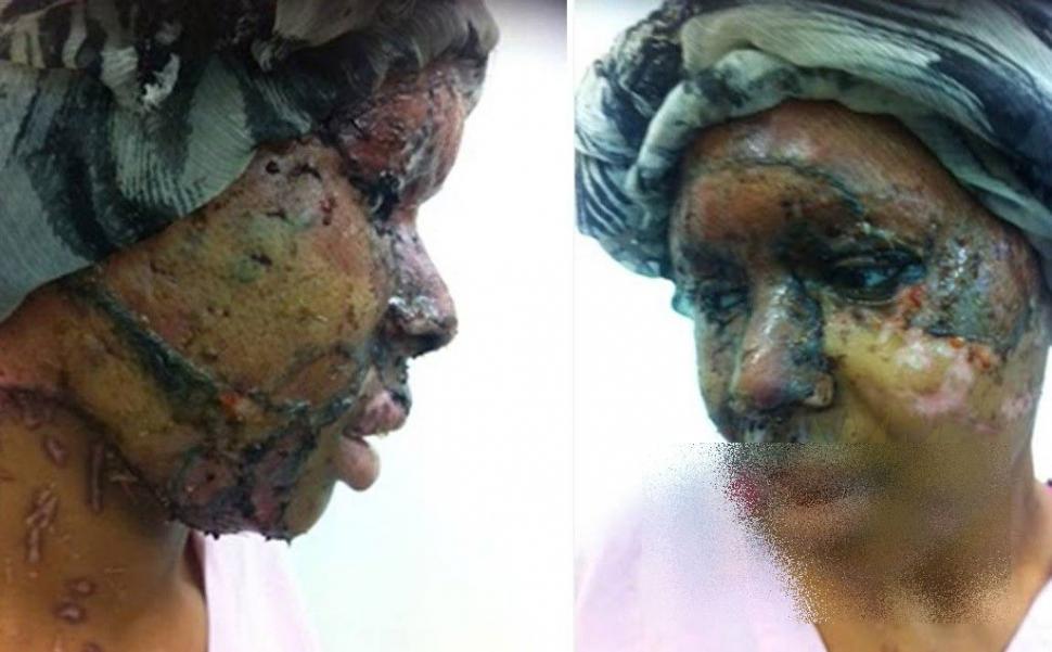 Mai avea 5 minute şi ajungea acasă. Ce i s-a întâmplat acestei tinere e îngrozitor. Acum nu se mai poate uita în oglindă 191673