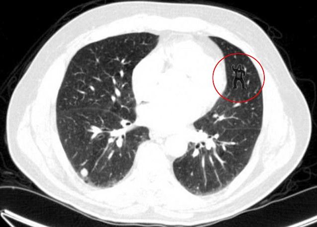 Testul care demonstrează că radiologii pot omite detalii vitale. Tu vezi gorila din imagine? 193005