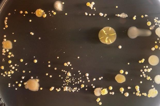 Imaginea microscopică ce îţi arată cât de periculos poate fi smartphone-ul tău. "Te poţi îmbolnăvi grav" 195096