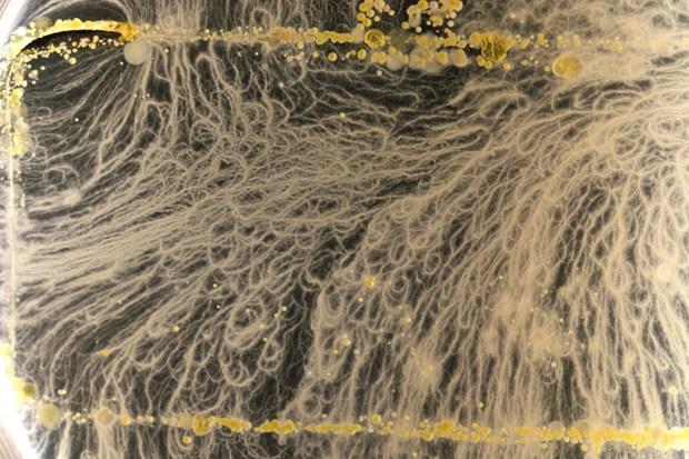 Imaginea microscopică ce îţi arată cât de periculos poate fi smartphone-ul tău. "Te poţi îmbolnăvi grav" 195097