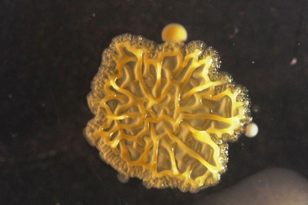 Imaginea microscopică ce îţi arată cât de periculos poate fi smartphone-ul tău. "Te poţi îmbolnăvi grav" 195098