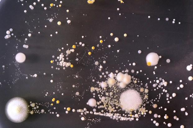 Imaginea microscopică ce îţi arată cât de periculos poate fi smartphone-ul tău. "Te poţi îmbolnăvi grav" 195099