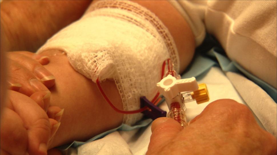 „În premieră” îţi prezintă povestea primului copil din România supus unor proceduri medicale de ultimă generaţie  199437