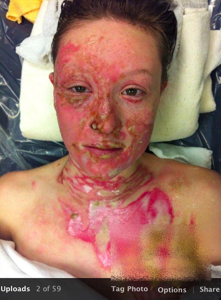 A ajuns să arate ca un monstru după ce a băut în club acest cocktail. O poţi păţi şi tu dacă nu eşti atent 199990