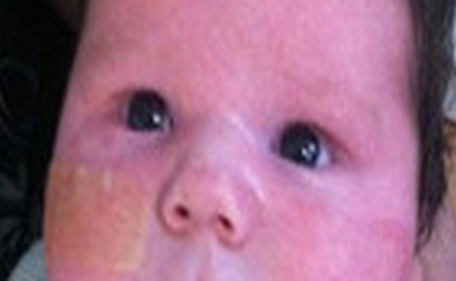 Naştere cu "greutate" în Marea Britanie: Cum arată bebeluşul de peste 7 kilograme 200712