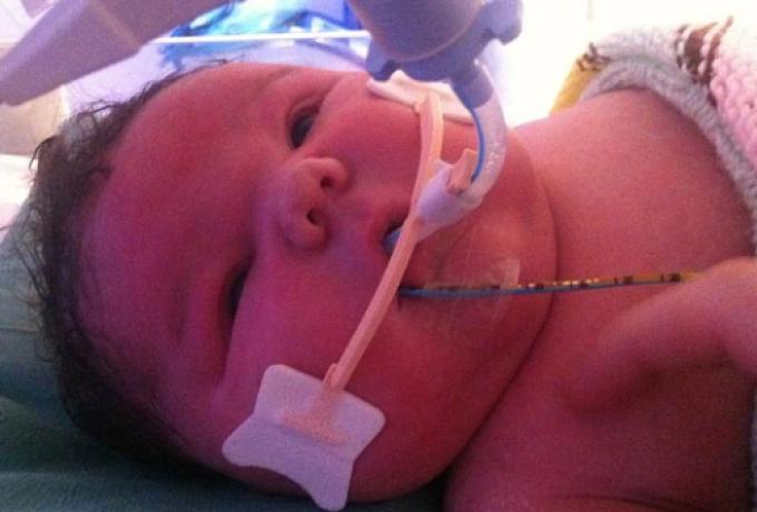 Naştere cu "greutate" în Marea Britanie: Cum arată bebeluşul de peste 7 kilograme 200714