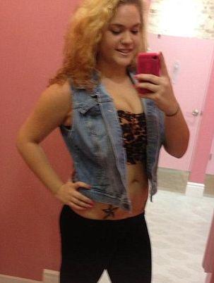 Viaţa acestei fete s-a schimbat într-o secundă. Drama înfiorătoare prin care trece a impresionat întreaga lume 201062