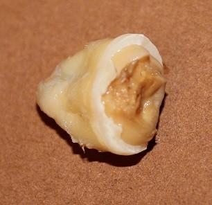 Cum ajung să arate dinţii tăi atunci când bei SUCURI ACIDULATE. Rezultatul unui EXPERIMENT care te va îngrozi 203188