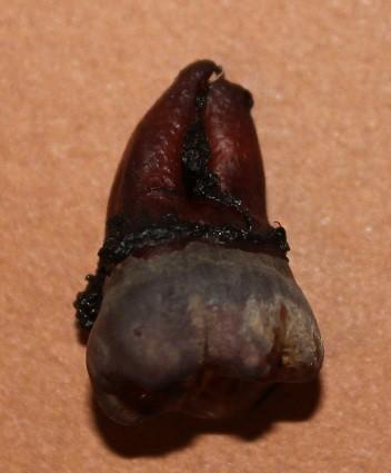 Cum ajung să arate dinţii tăi atunci când bei SUCURI ACIDULATE. Rezultatul unui EXPERIMENT care te va îngrozi 203193