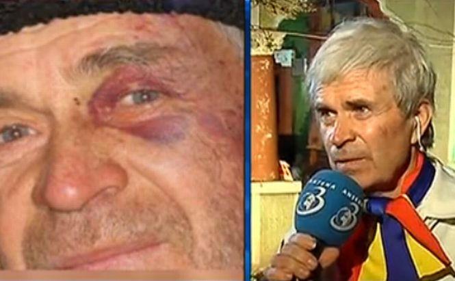 Bătrânul care a fost bătut în timpul protestelor din Piaţa Universităţii: Am strigat cât am putut „Jos Băsescu!”