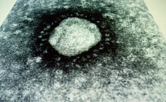 Specialiştii avertizează asupra noului coronavirus mortal: Se poate transmite de la om la om, ceea ce sporeşte riscul unei epidemii mondiale