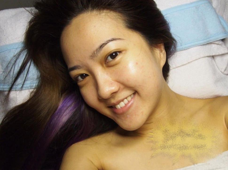 Ce i s-a întâmplat acestei fete frumoase după un simplu TRATAMENT COSMETIC. &quot;Sunt un MONSTRU. Nu mai pot ieşi din casă&quot; 212272