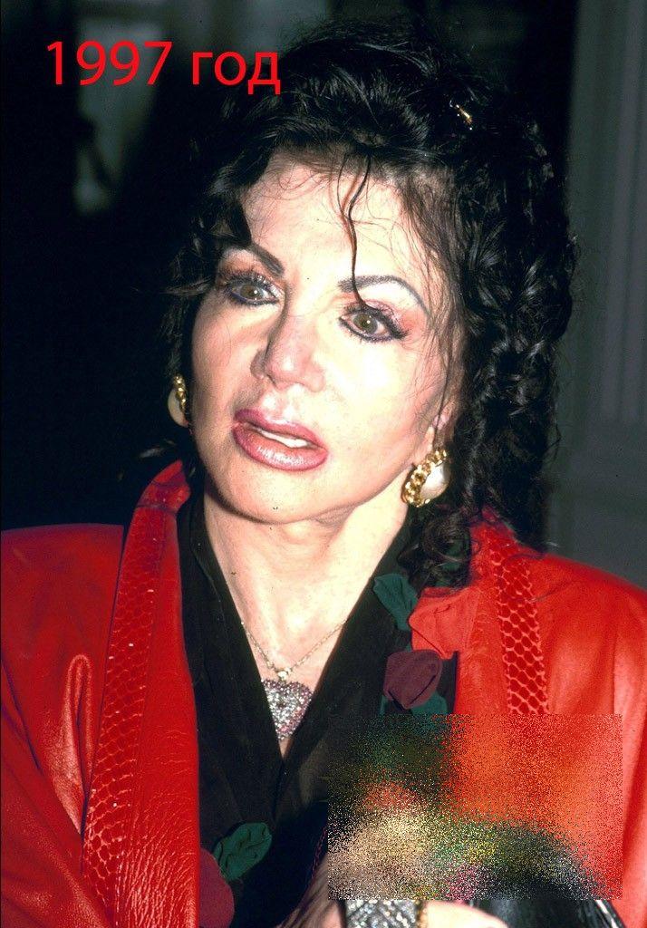 A fost una din cele mai frumoase femei ale Hollywood-ului. Acum arată ca un MONSTRU din cauza operaţiilor estetice 214158