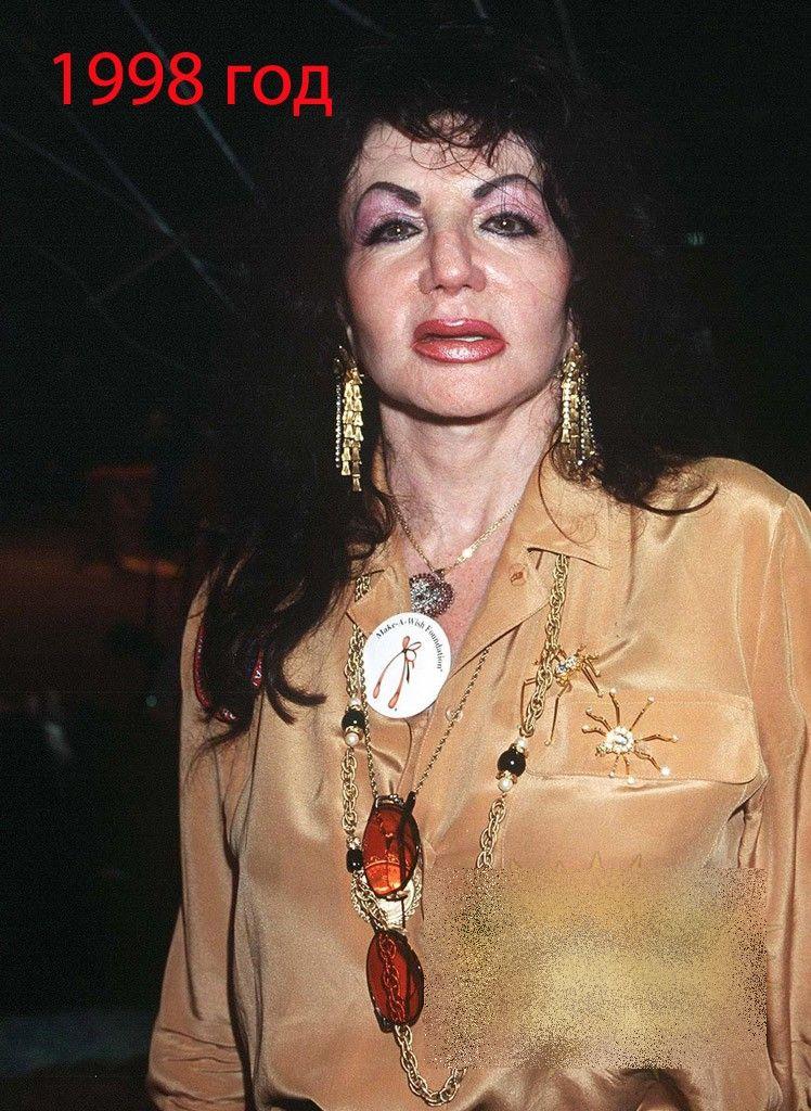 A fost una din cele mai frumoase femei ale Hollywood-ului. Acum arată ca un MONSTRU din cauza operaţiilor estetice 214160