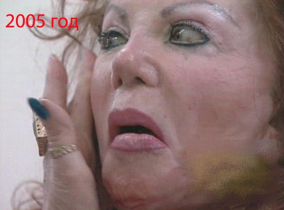 A fost una din cele mai frumoase femei ale Hollywood-ului. Acum arată ca un MONSTRU din cauza operaţiilor estetice 214162