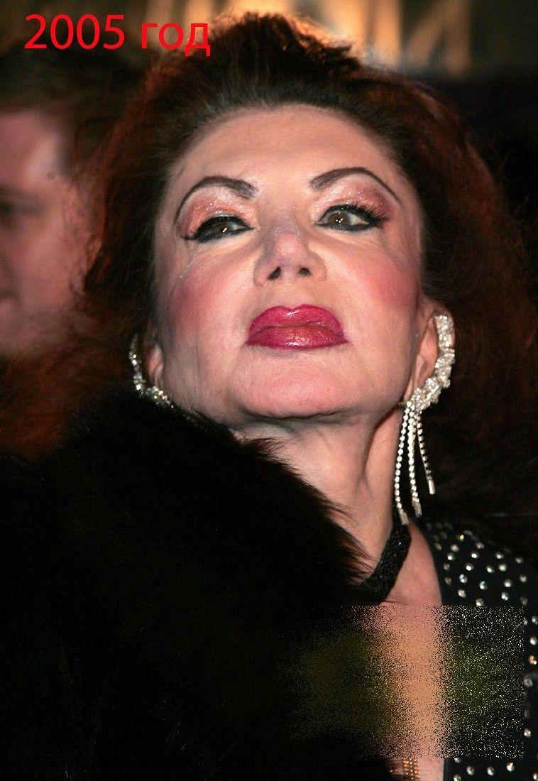 A fost una din cele mai frumoase femei ale Hollywood-ului. Acum arată ca un MONSTRU din cauza operaţiilor estetice 214164