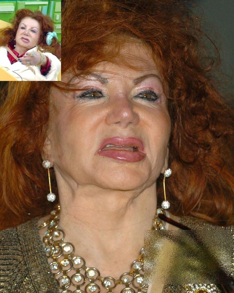 A fost una din cele mai frumoase femei ale Hollywood-ului. Acum arată ca un MONSTRU din cauza operaţiilor estetice 214165