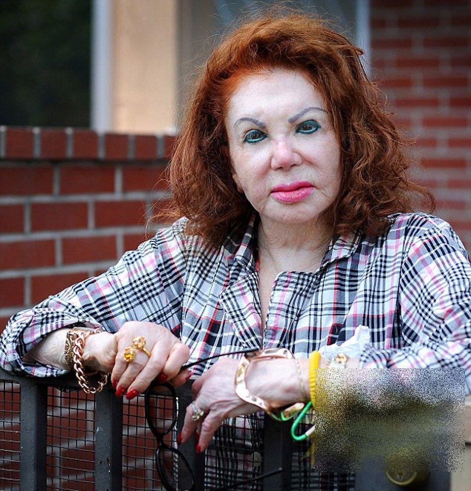 A fost una din cele mai frumoase femei ale Hollywood-ului. Acum arată ca un MONSTRU din cauza operaţiilor estetice 214172