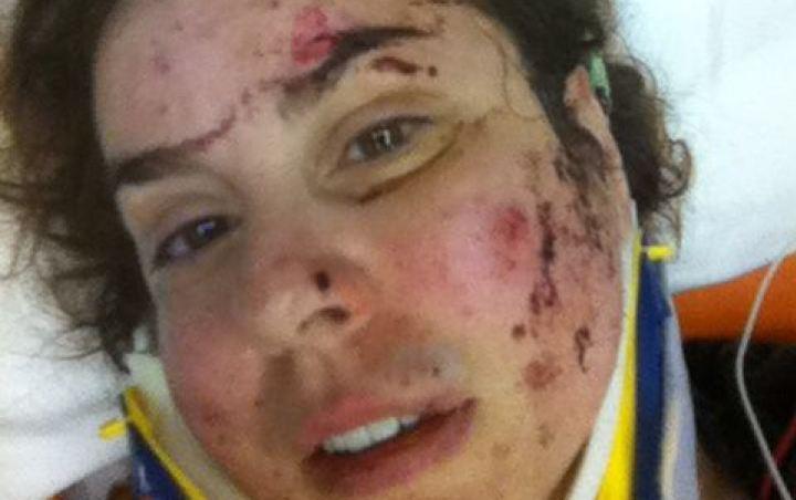 "Mi-a zdrobit capul de asfalt până când m-a umplut de sânge." Situaţia româncei a scandalizat opinia publică din Canada 221705