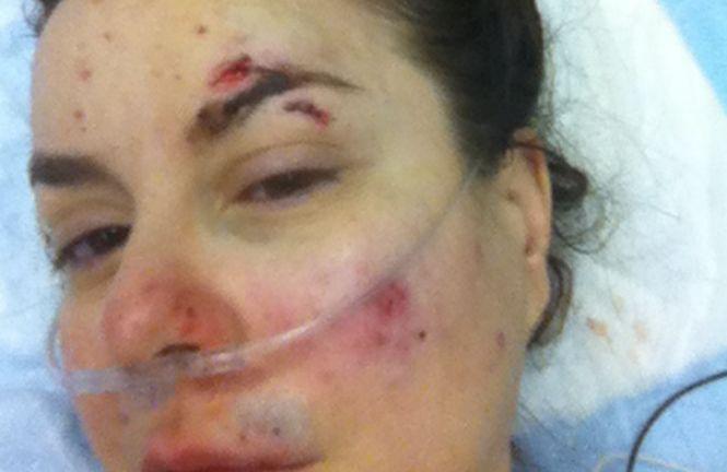 "Mi-a zdrobit capul de asfalt până când m-a umplut de sânge." Situaţia româncei a scandalizat opinia publică din Canada 221706