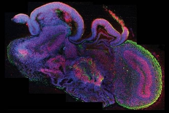 Primul creier uman în miniatură, dezvoltat în laborator de cercetătorii din Austria