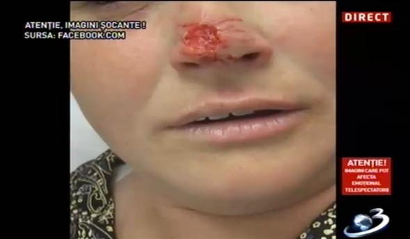 Imagini şocante! Oameni muşcaţi de câini maidanezi 224348