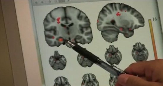 Doi medici români susţin că activitatea creierului nu se opreşte în moarte cerebrala