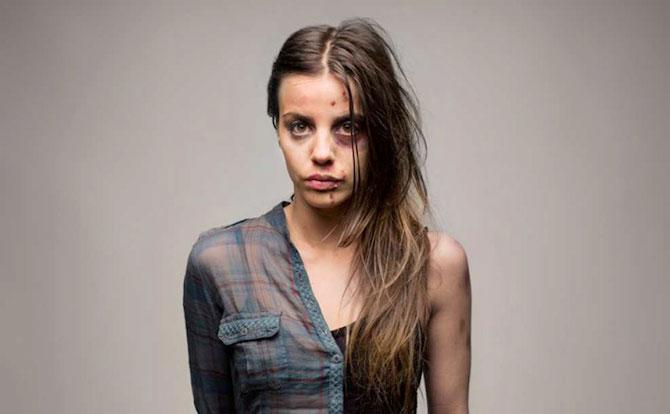 "Pe aici a trecut moartea albă". Efectele dependenţei de droguri, în fotografii cutremurătoare 228130