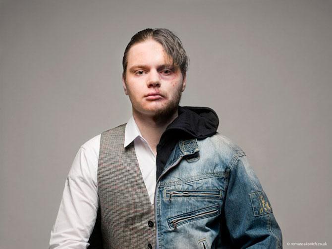 "Pe aici a trecut moartea albă". Efectele dependenţei de droguri, în fotografii cutremurătoare 228132