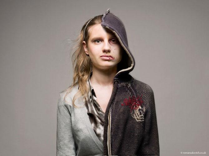 "Pe aici a trecut moartea albă". Efectele dependenţei de droguri, în fotografii cutremurătoare 228133