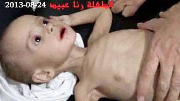 Fotografia cutremurătoare făcută în Siria. &quot;Asta este noua lor metodă de tortură&quot;