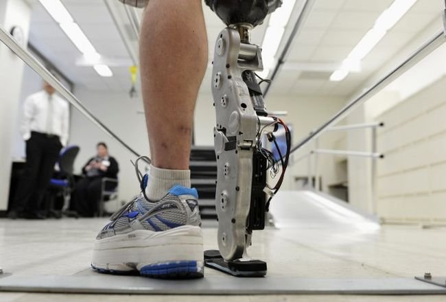 Premieră medicală. Primul picior bionic este complet funcţional