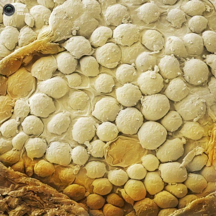 Alimentele, sub lupa microscopului. Câte ghiceşti fără să citeşti explicaţiile din fotografii? 230191