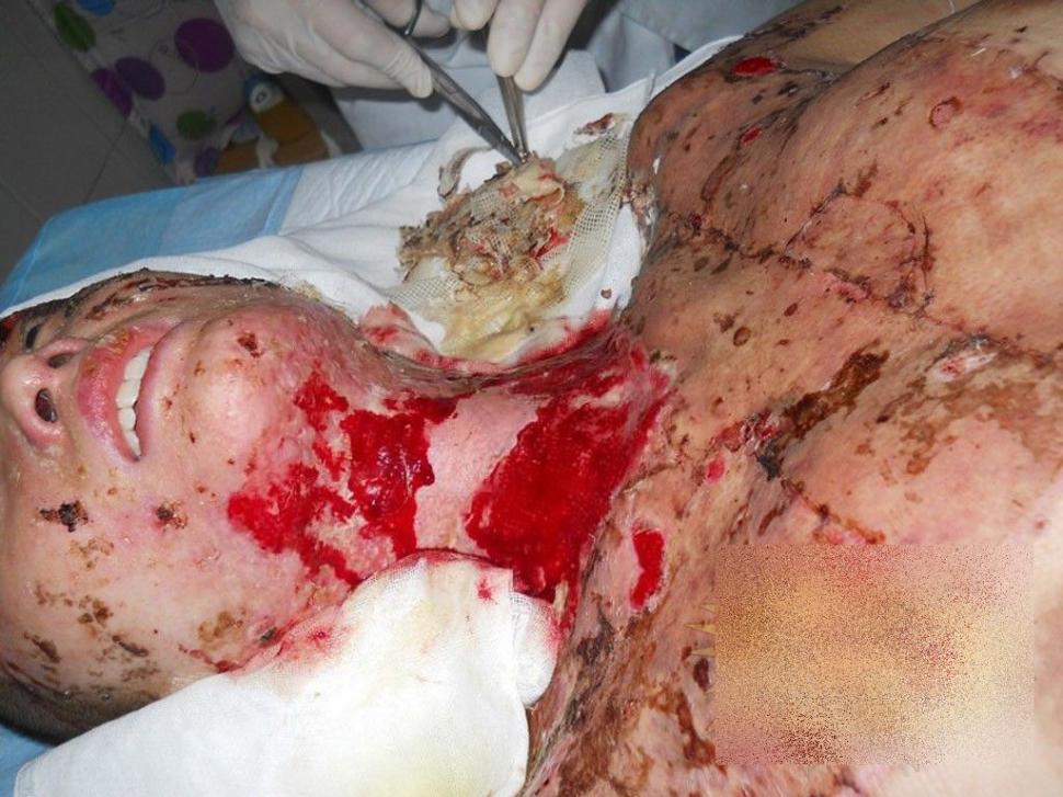 China.Ce i-a făcut acest MONSTRU iubitei lui pentru că a refuzat să se CULCE cu el 230380