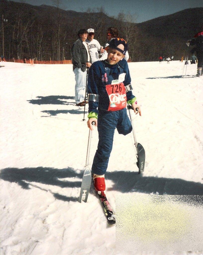 Ce se ascunde în spatele acestei fotografii. Vezi cum arată de la brâu în jos omul care a ales VIAŢA, după un diagnostic tragic 232043