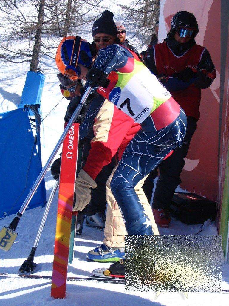 Ce se ascunde în spatele acestei fotografii. Vezi cum arată de la brâu în jos omul care a ales VIAŢA, după un diagnostic tragic 232045