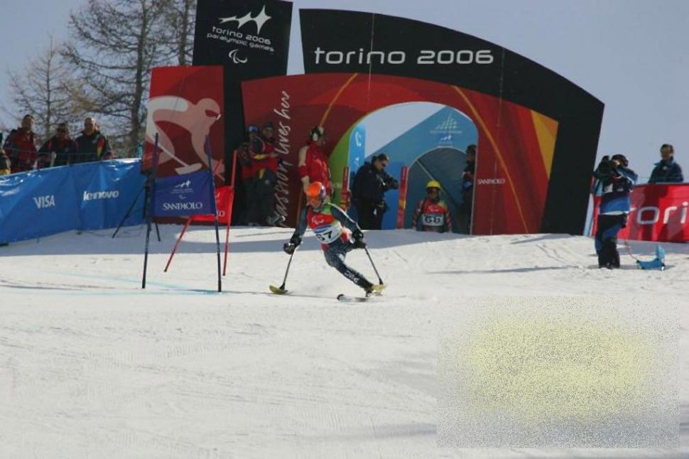 Ce se ascunde în spatele acestei fotografii. Vezi cum arată de la brâu în jos omul care a ales VIAŢA, după un diagnostic tragic 232046