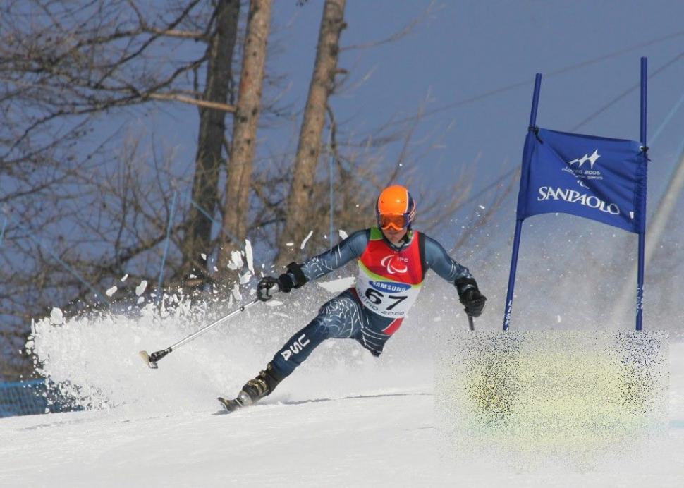Ce se ascunde în spatele acestei fotografii. Vezi cum arată de la brâu în jos omul care a ales VIAŢA, după un diagnostic tragic 232047