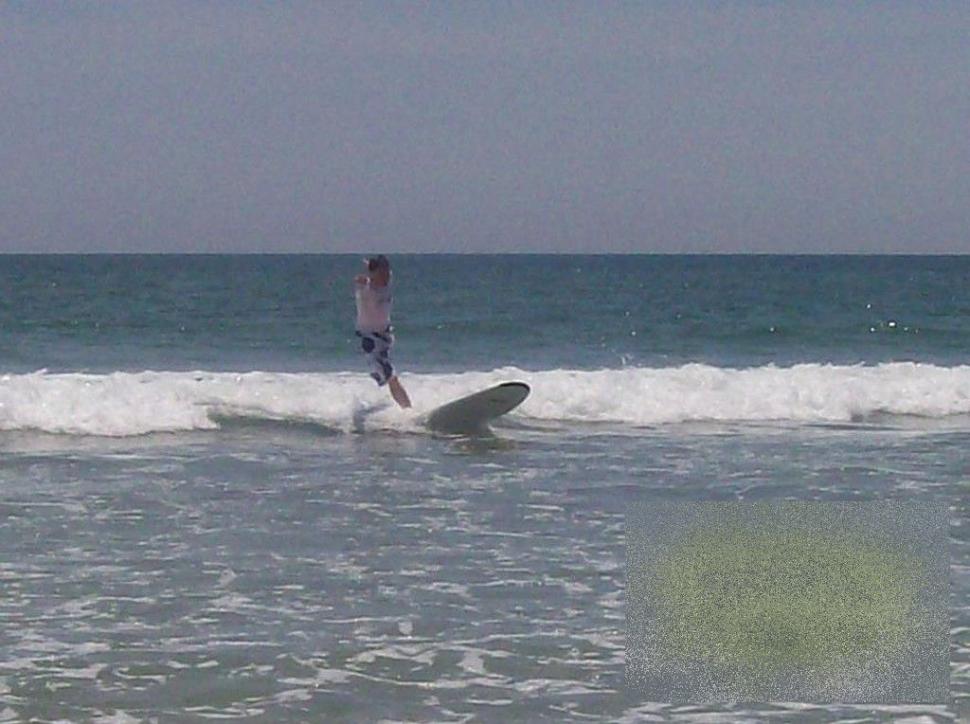 Ce se ascunde în spatele acestei fotografii. Vezi cum arată de la brâu în jos omul care a ales VIAŢA, după un diagnostic tragic 232054