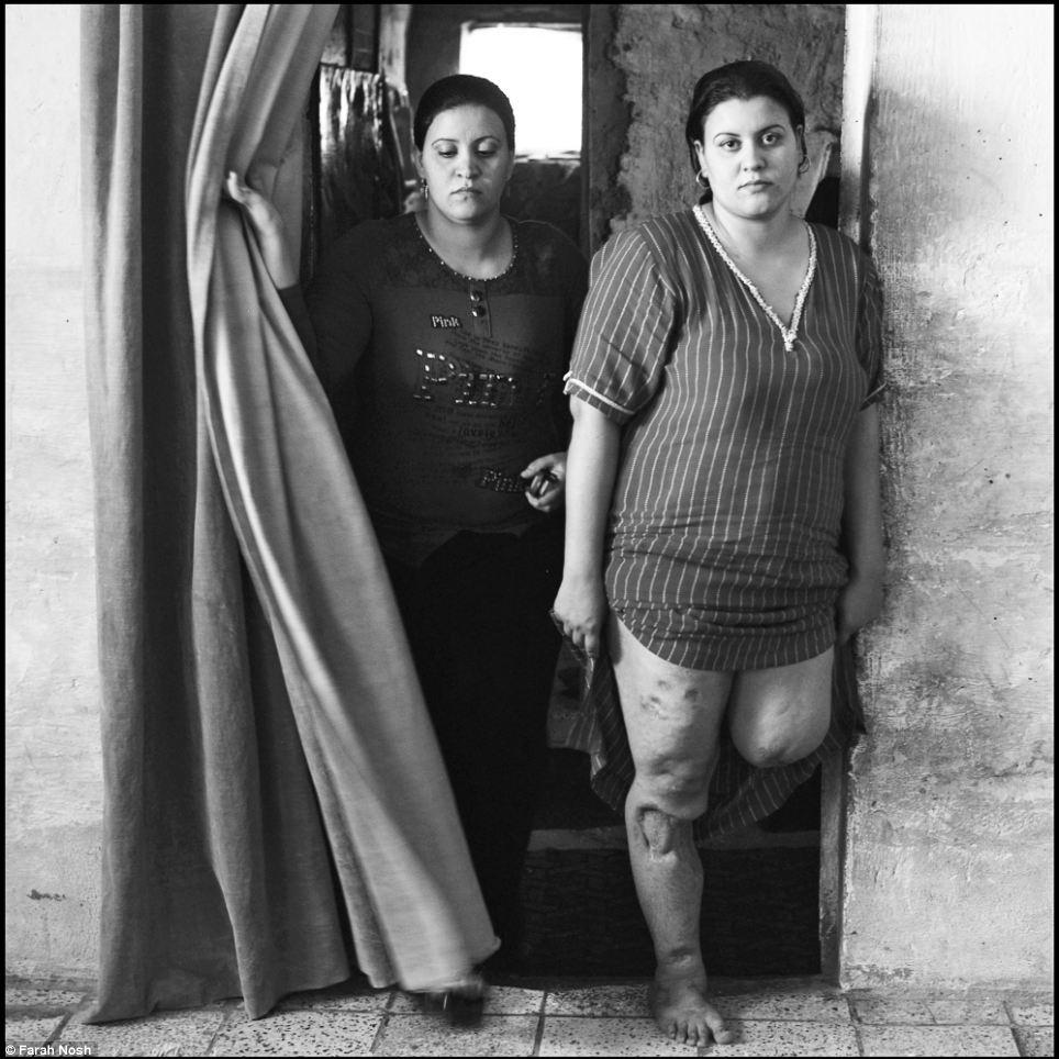 IMAGINI ŞOCANTE: Fotografii terifiante de război spun "Poveştile nespuse din Irak" 233656